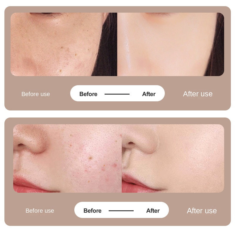 LCD dot mark pen home dot mark scanning pen laser beauty mole scanner